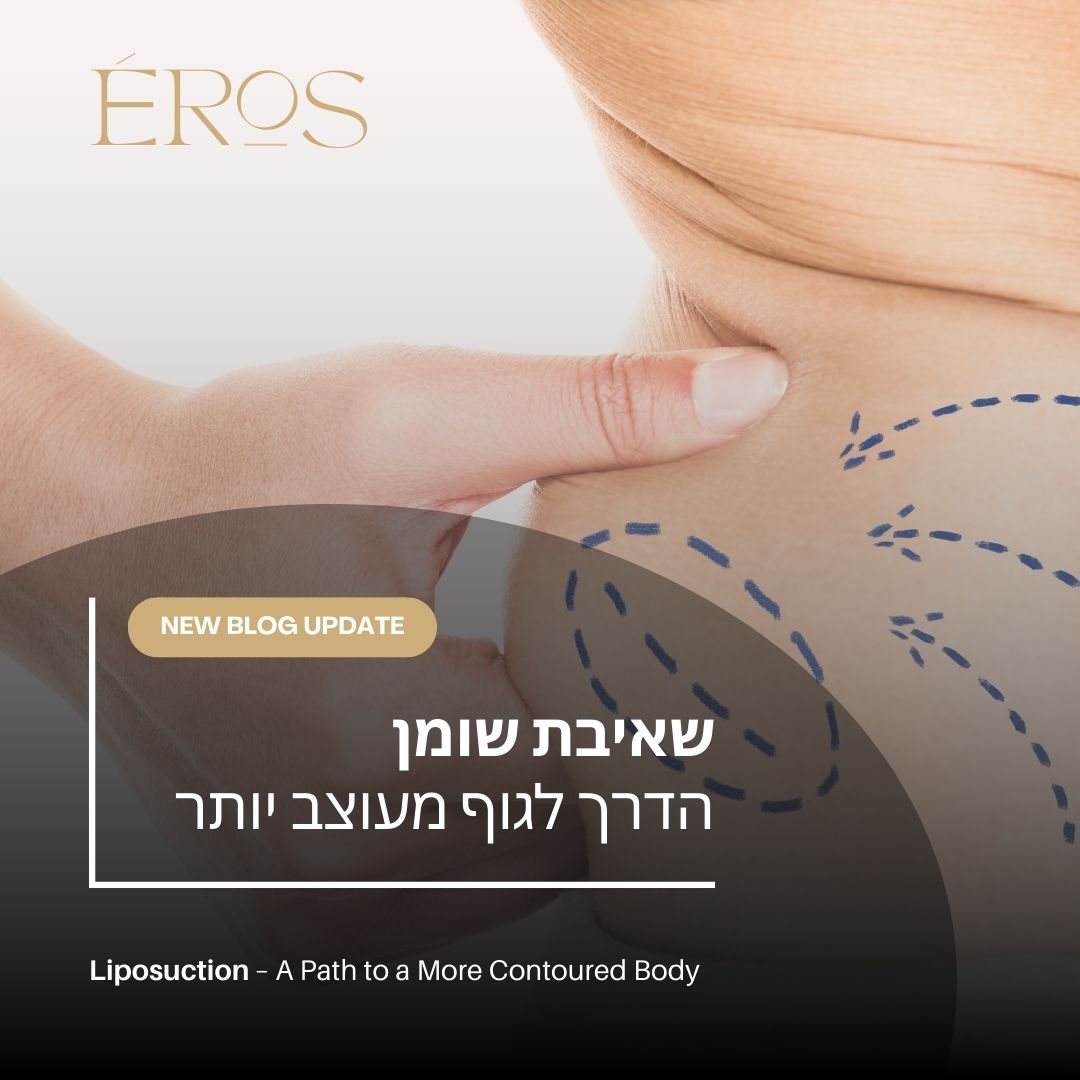 שאיבת שומן – הדרך לגוף מעוצב יותר (הסבר)